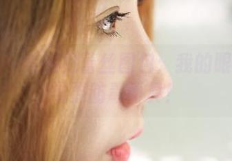 蜜桃社 – 美绪的蕾丝图包：我的眼睛暂时需要防毒面具！